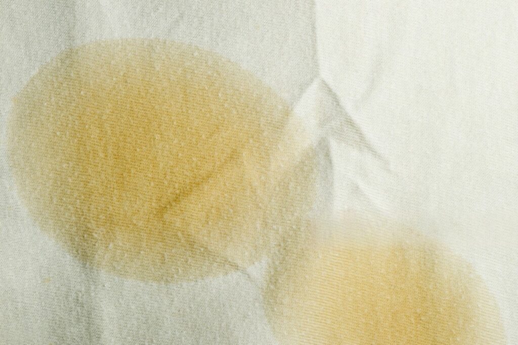 How body oils and sweat cause yellow stains on pillowcases diagram
