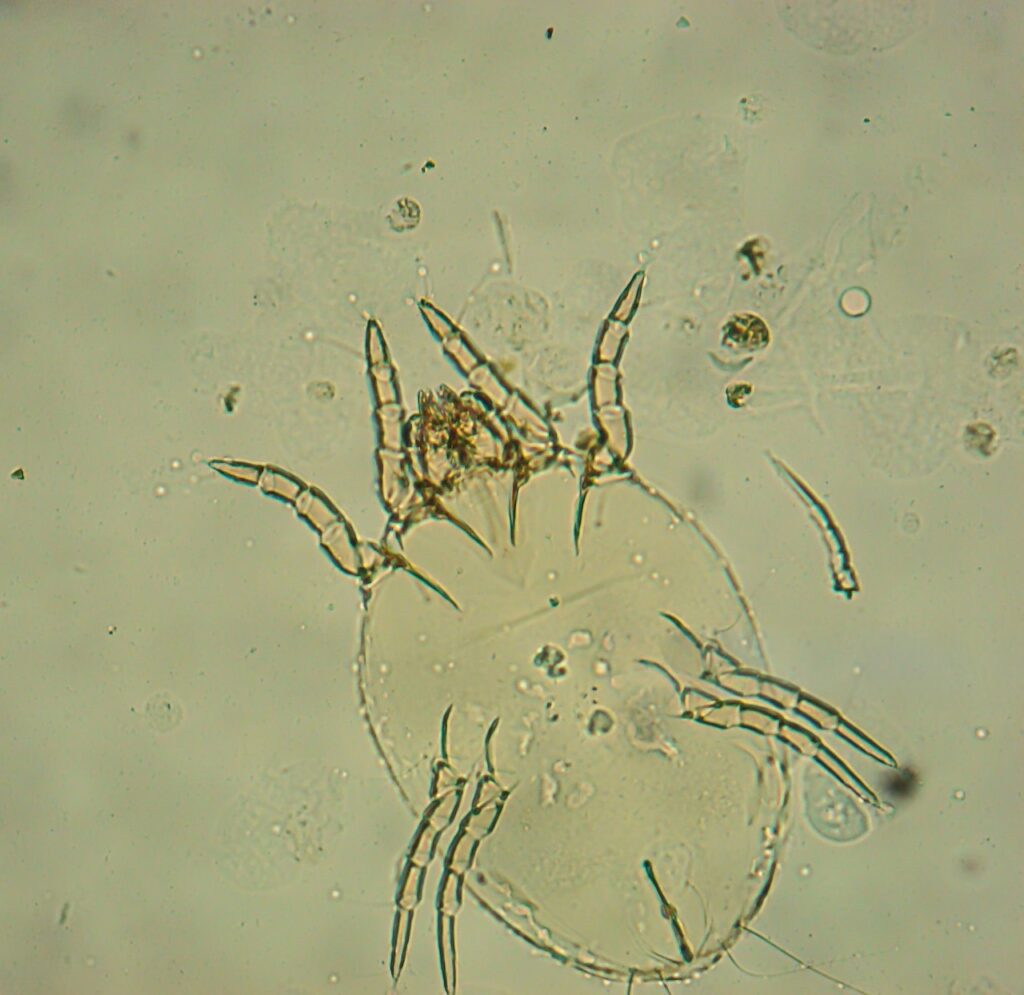 Image: A microscopic view of a dust mite. Their waste products are a common irritant.